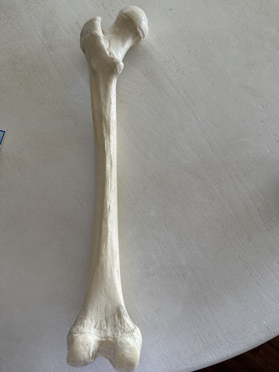 Femur bone plastic