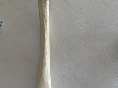 Femur bone plastic