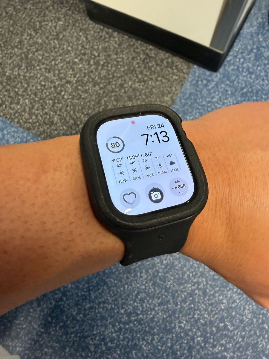 Apple Watch Series 10 - 46mm