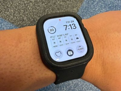 Apple Watch Series 10 - 46mm