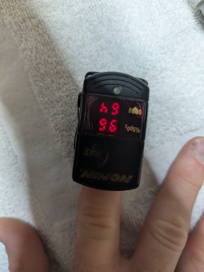 Nonin Onyx 9590 Pulse Oximeter