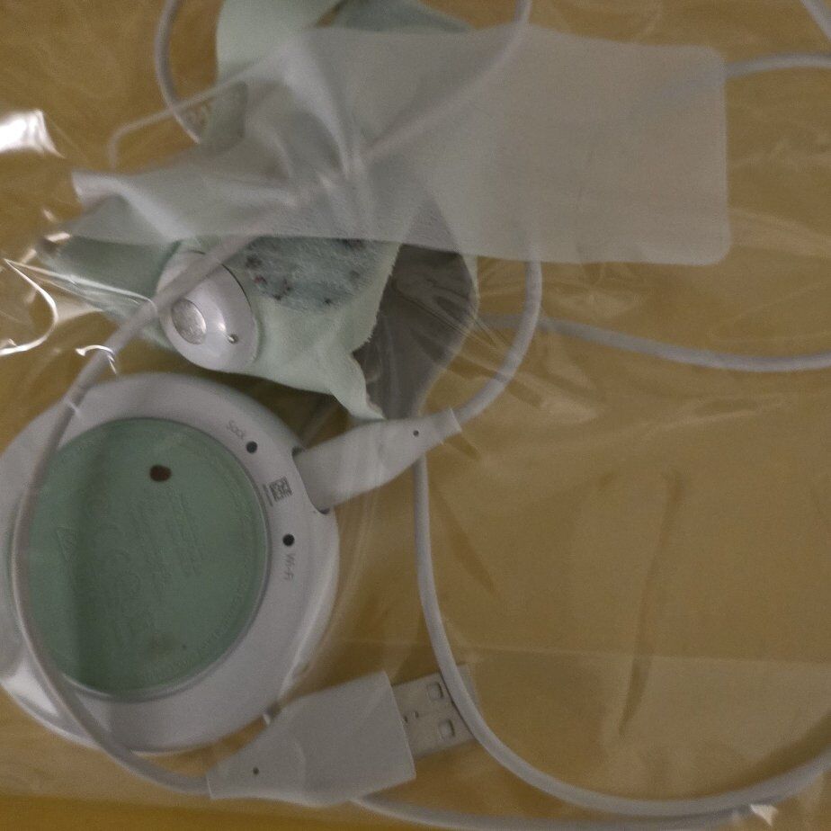 Owlet SmartSock baby monitor