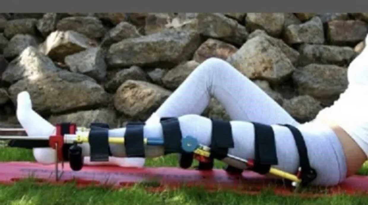 Reel Splint System Traction Splints