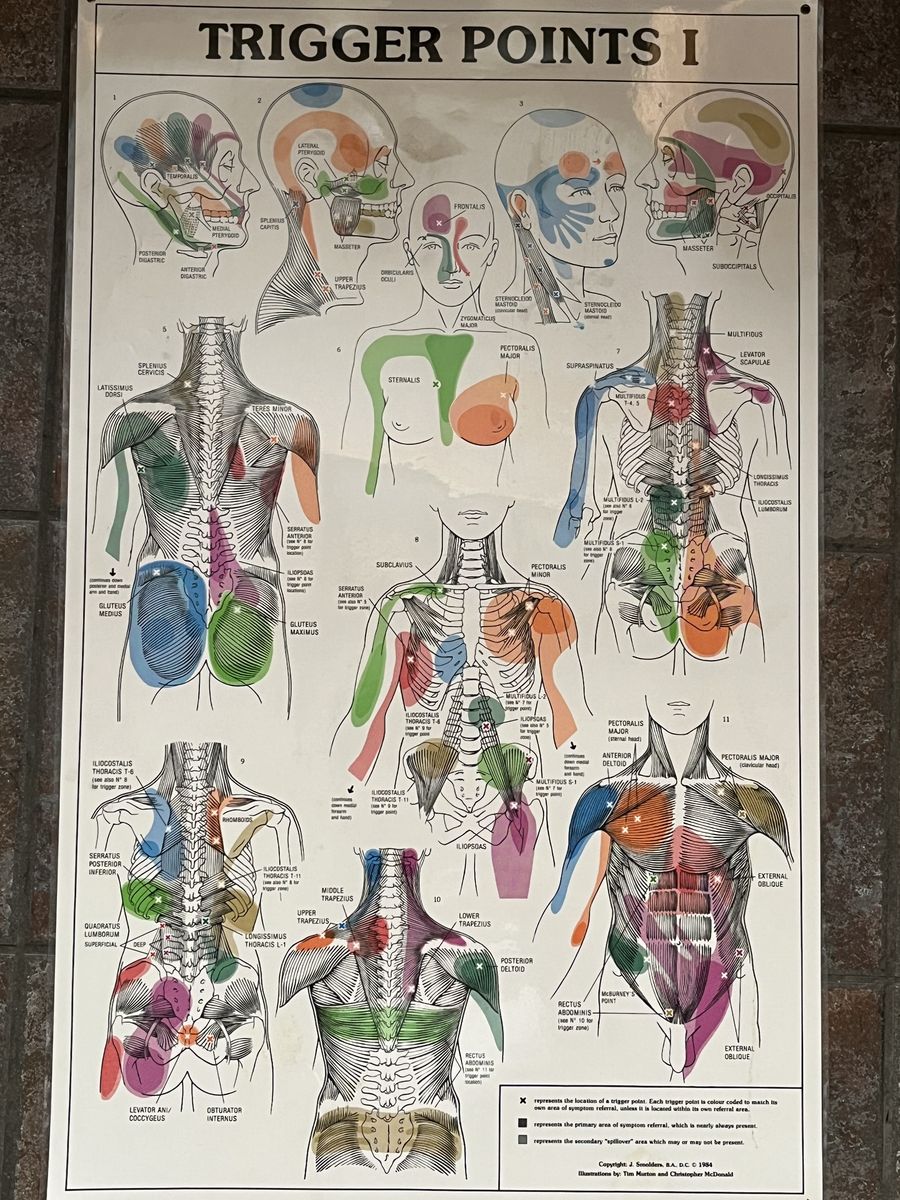 Trigger point posters