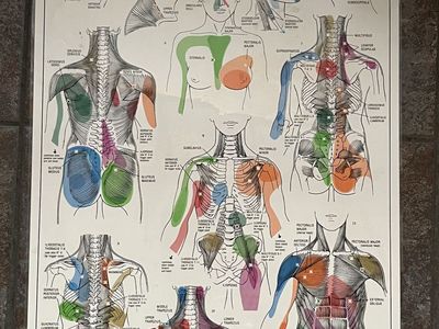 Trigger point posters