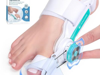 NEW Bunion Corrector Big Toe with Precision Angle Marker, Bunions Fix for Relief, Fits Left and Right Feet, Green-1pc