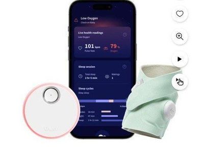 Owlet Dream Sock & Sensor