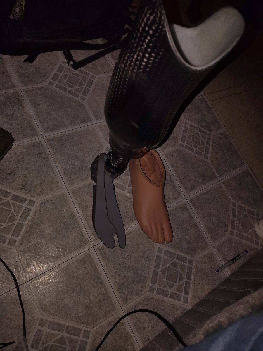 Carbon fiber prosthetic leg