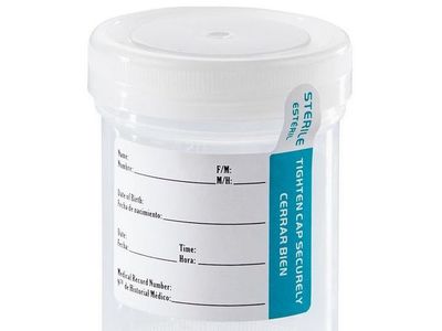 SAVE 50%! NEW Medical Liquid Sample Containers - 120 mL / 4 oz. Capacity - Sterile - Sold in Bags of 75 pcs.