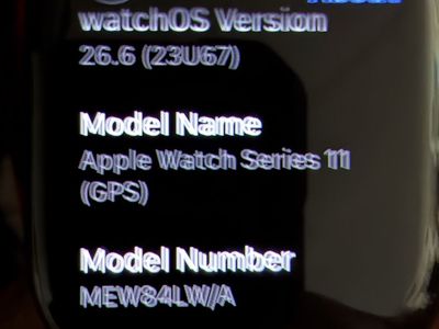 Apple Watch Series 11 46mm — Pristine Condition | Like New | $375 OBO