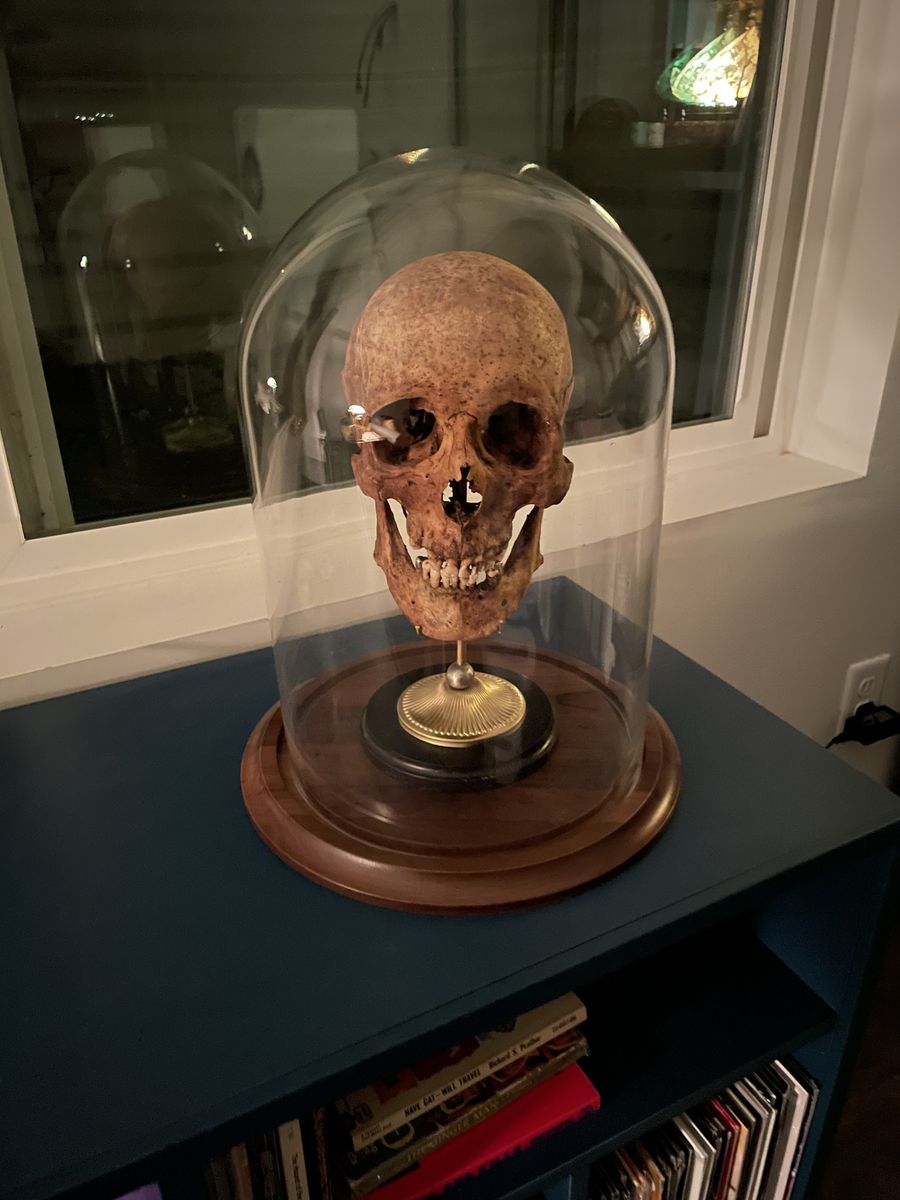 H.s. Sapiens Complete Skull w/ 2 Gold teeth on Walnut Plinth in Hand-blown Glass Dome