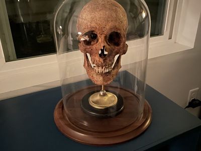 H.s. Sapiens Complete Skull w/ 2 Gold teeth on Walnut Plinth in Hand-blown Glass Dome